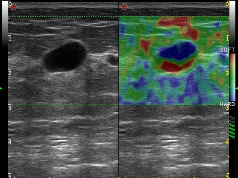 DTlMedical_MyLaOmega_esaote_ecografie_Dual_ElaXto_img1