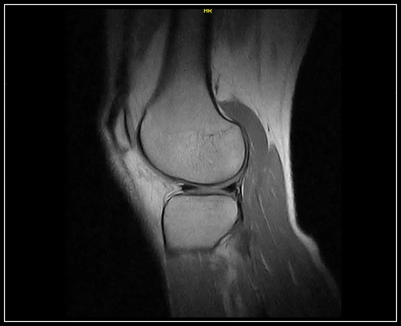 DTLMEDICAL_esaote_rmn_gscan_brio_genunchi