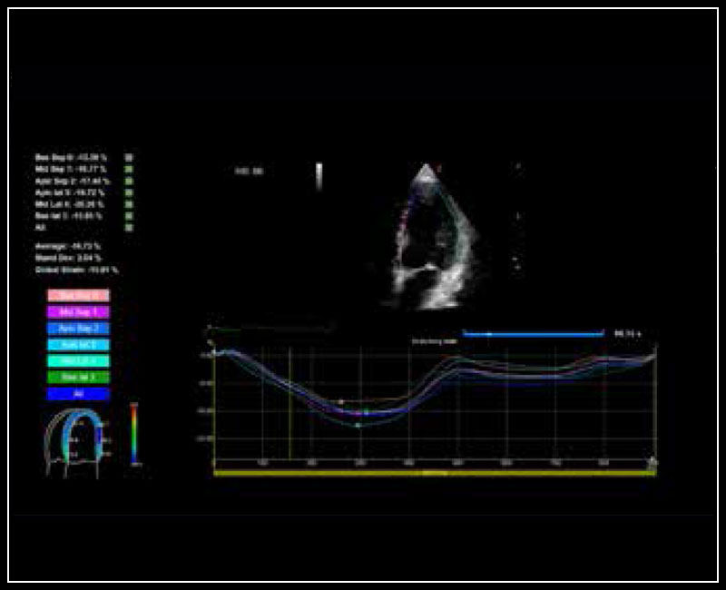 dtlmedical-esaote-ecograf-MyLabX8VET-ecografie-caine-B-Mode-img5