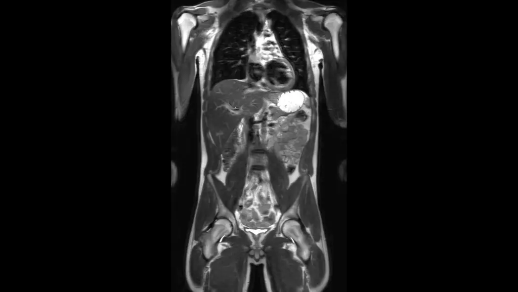 DTLMEDICAL_philips_rmn_ELITION_S_3T_imagine_clinica_1