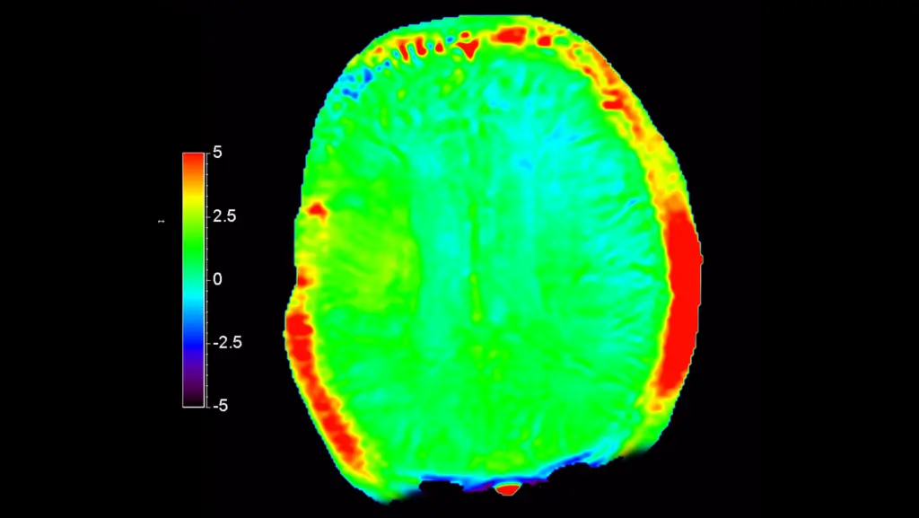 DTLMEDICAL_philips_rmn_ELITION_S_3T_imagine_clinica_3