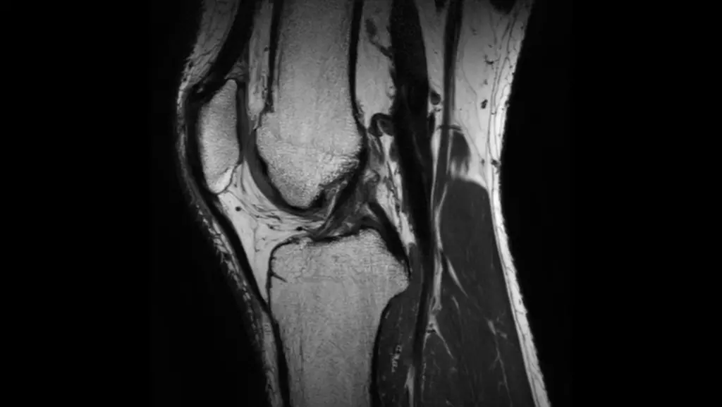 DTLMEDICAL_philips_rmn_ELITION_S_3T_imagine_clinica_5