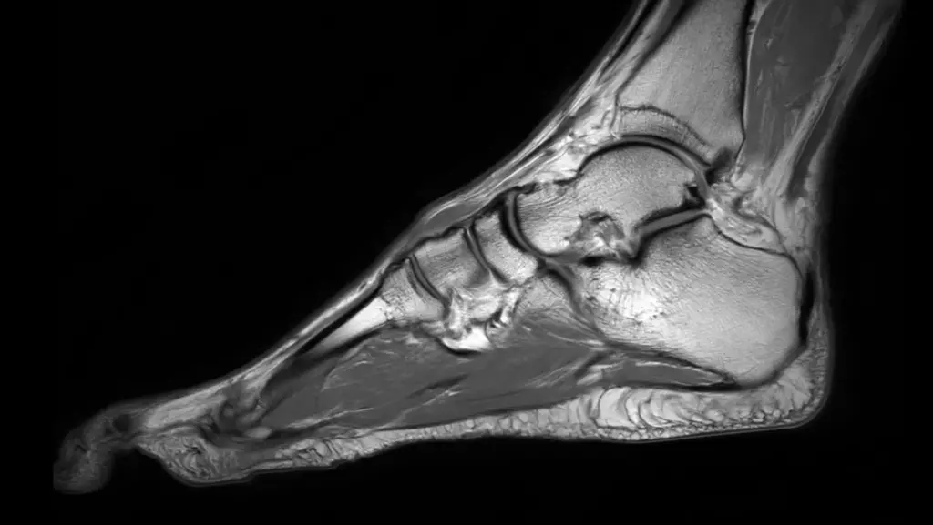 DTLMEDICAL_philips_rmn_ELITION_S_3T_imagine_clinica_6
