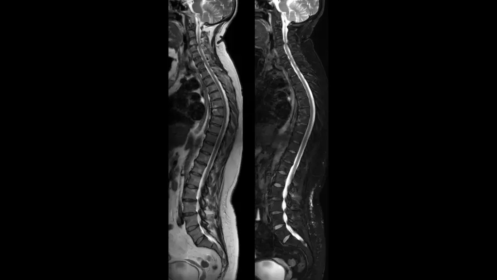 DTLMEDICAL_philips_rmn_ELITION_S_3T_imagine_clinica_7