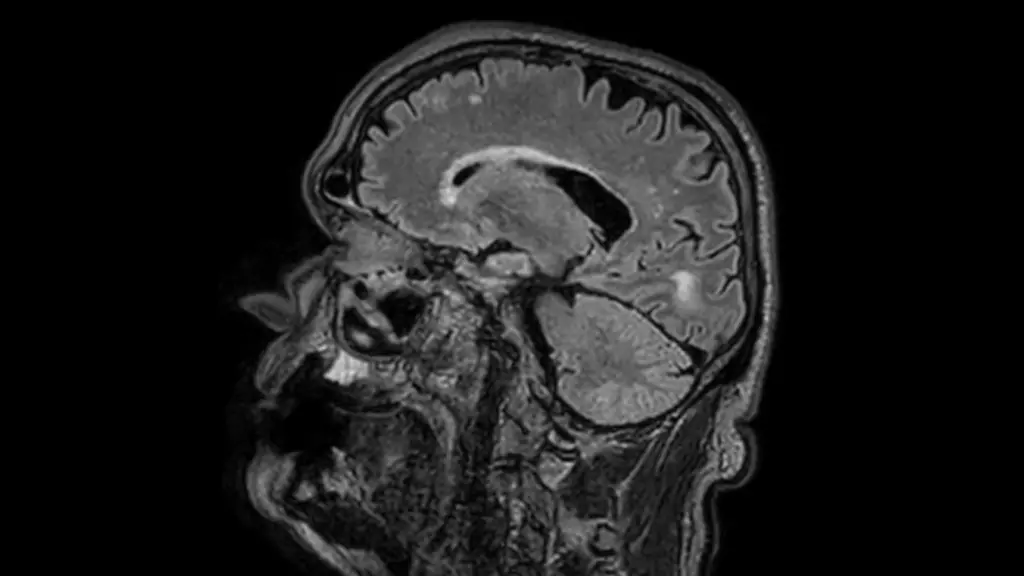 DTLMedical_philips_rmn_ingenia_ambition_S_1.5T_imagine_clinica_img1