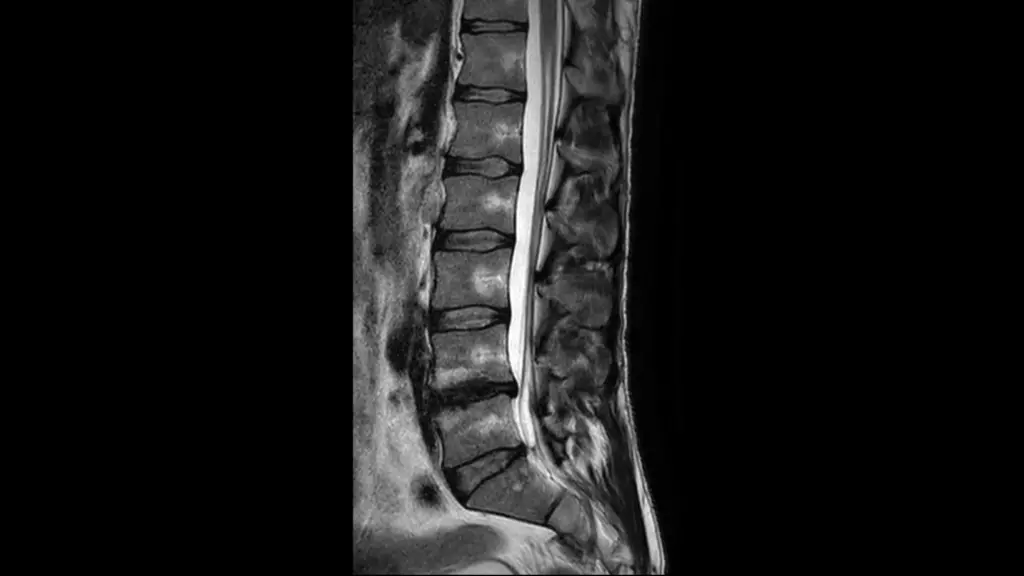 DTLMedical_philips_rmn_ingenia_ambition_S_1.5T_imagine_clinica_img3