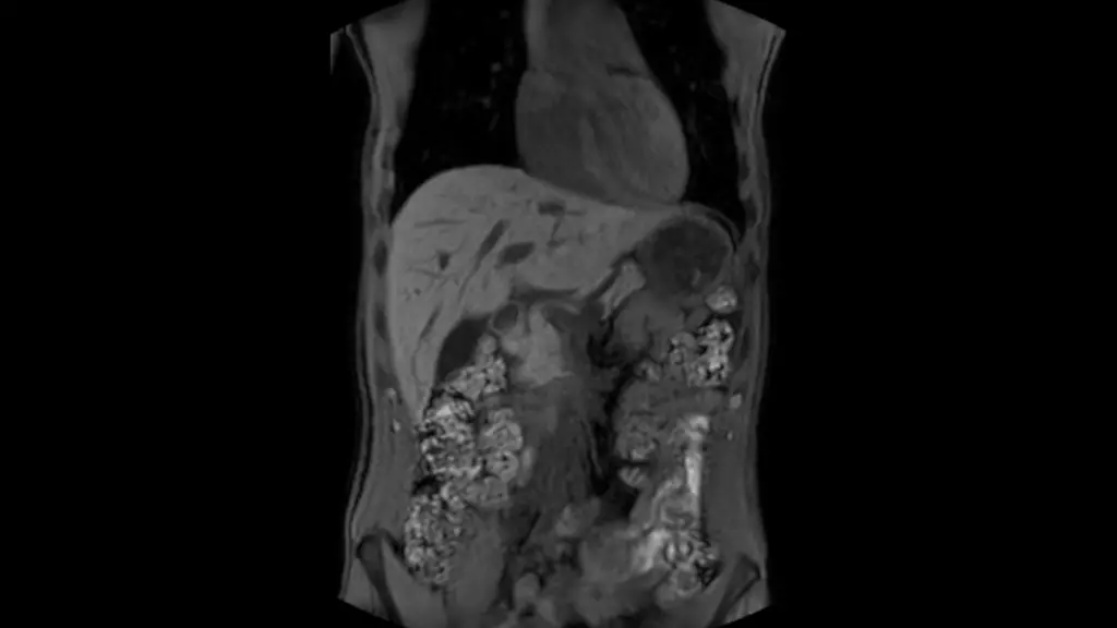 DTLMedical_philips_rmn_ingenia_ambition_S_1.5T_imagine_clinica_img6