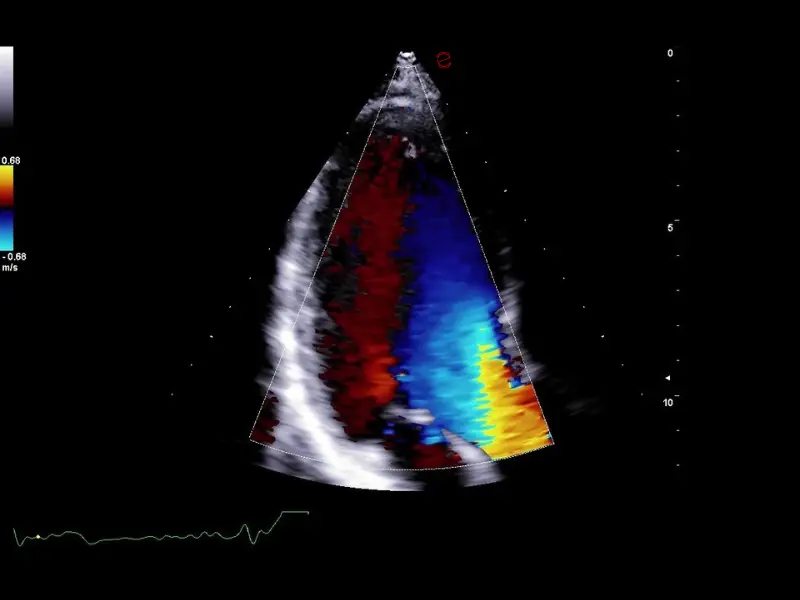 csm_esaote-clinical-images-C30-CFM-3CH_da3bc35e18