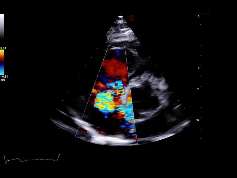 csm_esaote-clinical-images-C30-CFM-TR_8d2150631c