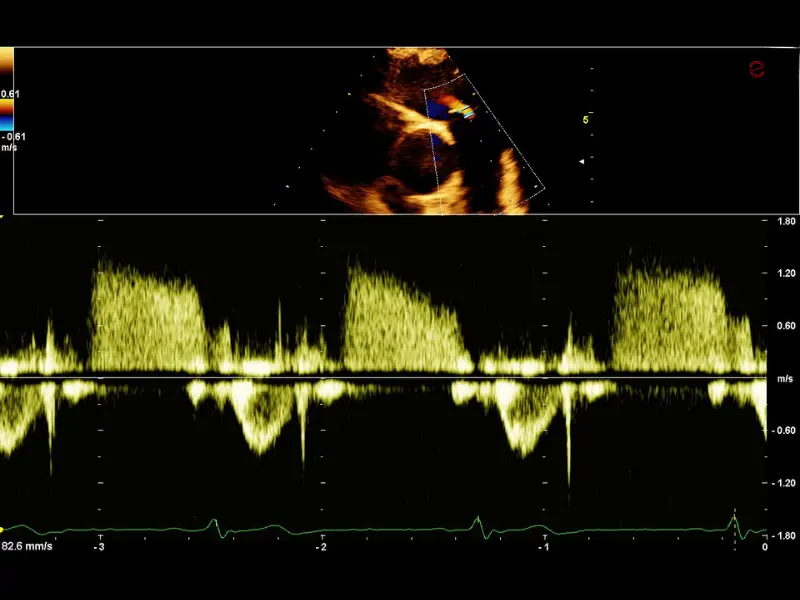 csm_esaote-clinical-images-C30-Doppler-CW_363a72f1fe