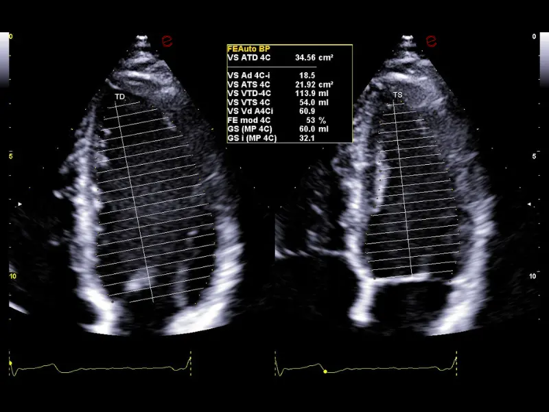 csm_esaote-clinical-images-C30-FE_8dc67accbd