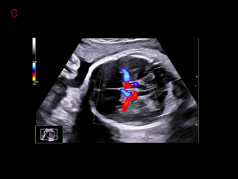 csm_mylab-c30-MCA_676ec65740