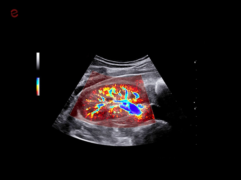 csm_mylab-c30-MICROV-NEW_f92a44f0c3