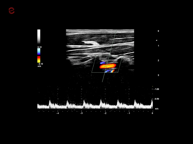 csm_mylab-c30-image-08-vertebral-PW-ML30_6a8a8c7f76