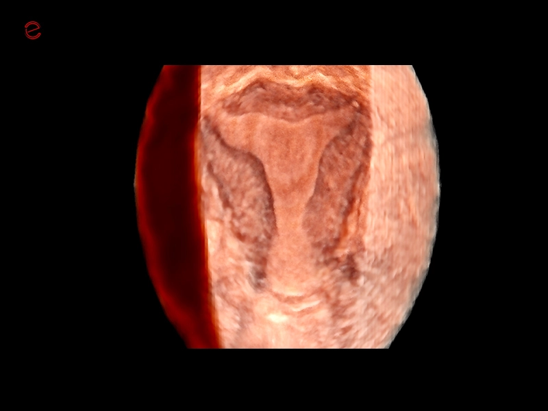 csm_mylab-c30-image-09-gyn-3D_a430102952