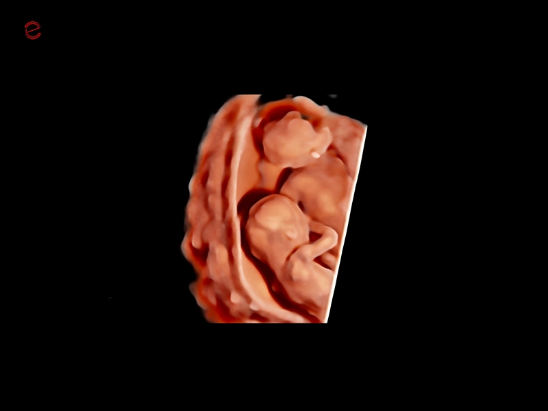 csm_mylab-c30-image-18-4D-VC2-9_dafe53c2f6